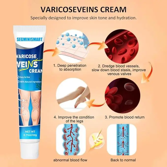 CREMA PARA VENAS VARICOSAS	1 Foto 7234070-6.jpg