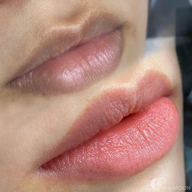 Transforma tu belleza en Dermavique Clinic! Foto 7260216-2.jpg