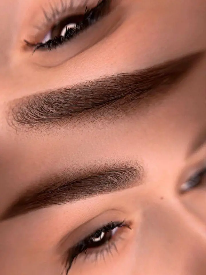 Transforma tu belleza en Dermavique Clinic! Foto 7260216-6.jpg